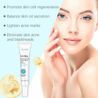 Gel limpiador para el acné OUHOE, gel hidratante con niacinamida para el acné, limpiador suave que reduce la grasa y atenúa el acné. - details 8