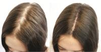 Opal Beauty - Masajeador Capilar de Bambú con Cerdas de Silicona Suaves - Ideal para Estimular el Cuero Cabelludo, Relajar, Mejorar la Circulación Sanguínea, Reducir el Estrés, Promover el Crecimiento del Cabello, Limpieza Profunda y Masajes Antiestrés - details 0