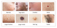 Pluma de Plasma Eléctrica | Eliminador de Manchas y Etiquetas de Piel | Equipo de Belleza Portátil | 9 Niveles Ajustables | Uso Doméstico - details 10