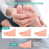 Pexmen Corrector De Dedos De Terciopelo 2/4Pcs Para Dedos Curvados Torcidos Y Enclavados Almohadilla De Apoyo Para Dedos - details 7