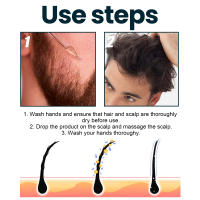 1 juego de suero para el crecimiento del cabello, tratamiento fortalecedor del crecimiento del cabello para hombres, tratamiento fortalecedor del crecimiento del cabello para el adelgazamiento del cabello y la caída del cabello - details 3