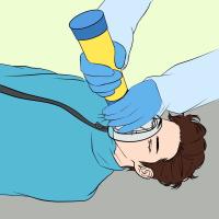 Nueva Actualización Dispositivo Antigolpe Portable Vida Guardia Emergencia Anti Ahogamiento Succión Vac Primera Aid Kit Para Niños Y Adultos - details 15