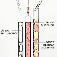 Pack Kérastase Gloss Absolu Bain Crème Hydra-Glaze + Insta Glaze + Glaze Drops – Brillo y Control del Frizz - details 0