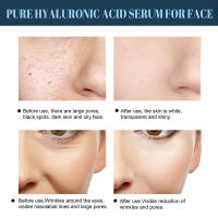 60Pcs Hilo De Colágeno Dorado Antienvejecimiento Lines Finas Antiarrugas Firmeza Facial Filler Absorbible Sin Agujas Serum De Cuidado De La Piel - details 3