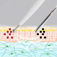 Accesorio Para Máquina De Firmación Y Blanqueamiento De Piel Galvanic Microcurrent Iontóforo Anti-Edad Masajeador De Cuidado De La Piel Pieza Única Material Plástico Y Acero - details 4