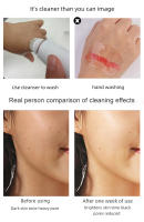 Cepillo de limpieza Facial eléctrico 4 en 1, herramienta de limpieza Facial recargable, impermeable, giratorio, limpiador de poros, máquina de piel Facial - details 8