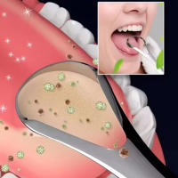 Limpieza Oral Adulto Limpieza De Lengua Silicone Escáner De Lengua Elimina Halitosis Recubrimiento De Lengua Cepillo De Escarificación Herramienta De Cuidado Oral - details 2