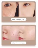 Eliminador de etiqueta de piel-Para tratamientos Caseros y Secretos, Carbonatación Iónica, Herramientas de Belleza Nine Degrees - details 2