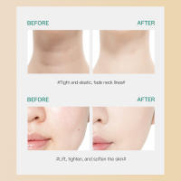 Nueva Máquina De Masaje Facial EMS Belleza 3 En 1 Elevador De Piel Para Lifting Corporal Y Corporal Con Masaje De Ojos Y Cuello Anti-Edad - details 16
