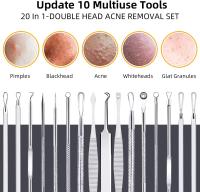 10 piezas Blackhead Remover Pimple Popper Tool Kit,Comedone Extractor herramientas para acné, blackhead, Whitehead, espinillas, manchas - details 0