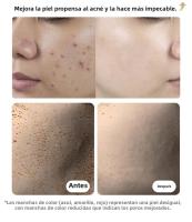 Máscara Facial LED De Terapia De Luz Roja Anti-acné Y Eliminación De Arrugas Rejuvenecimiento De La Piel Blanqueamiento Dispositivo De Belleza Del Rostro Con Carga USB - details 8