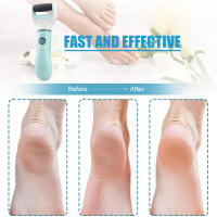 Pulidora De Pies Inalámbrica Recargable USB Impermeable Portátil Anti Callos Y Piel Muerta Herramienta De Pedicura Para Cuidado De Los Pies Resistentes a Las Roturas - details 2