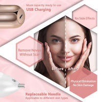Pluma de Plasma Eléctrica | Eliminador de Manchas y Etiquetas de Piel | Equipo de Belleza Portátil | 9 Niveles Ajustables | Uso Doméstico - details 6