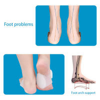 1Par De Soporte Arco Para Pies Antideslizante Alivio Del Dolor De Talón Asistencia En El Cuidado De Los Pies Absorbe Choques Con Suela No Slip Para Plantar Fasciitis - details 11