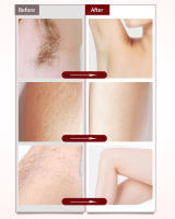 Epilador Recargable 2 En 1 Para Mujer Trimmer De Cejas Y Cuerpo Peine De Peluca Mini Afeitadora Painless Para Cara Y Axilas - details 8