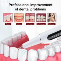 Escáner Dental Ultrasonido Xiaomi Youpin 2.8M/min Limpieza De Dientes Alisadora De Placa Y Calcario Con Vibración De Alta Frecuencia Para Adultos Recargable - details 3