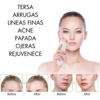 con Pantalla Máquina Facial para Eliminar las Arrugas Masajeador Ultrasonidos RF EMS LED Rejuvenecimiento Antienvejecimiento Cuello Barbilla Cara Regenerador Terapia en Casa Regalar Mujer Radiofrecuencia - details 0