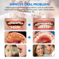 Limpieza Dental Ultrasonica Eliminador De Calcar Y Placa Escáner Dental Eléctrico Blanqueador De Dientes Para Adultos Recargable - details 5