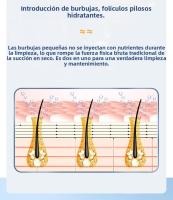 Aparato Limpieza Facial Profesional-Eliminar Puntos Negros Device with 6 Boquillas - Tecnología de Succión y Oxigenación - 3 NIVeles de Potencia Ajustable - Recargable USB - details 8