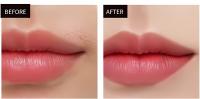 Dispositivo De Eliminación De Vello IPL Para Mujeres 990000 Flashes Láser Permanente Sin Dolor Para Cuerpo Bikini Y Cabello Facial Uso Doméstico - details 7