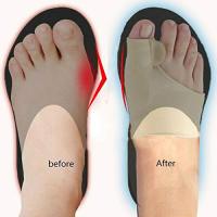 2 UDS. Calcetines ortopédicos para corrección de juanetes y Husos grandes, corrector de hallux valgus de silicona - details 0
