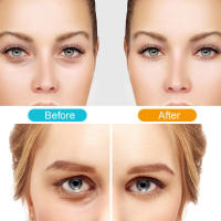 Dispositivo De Relajación Ocular EMS Terapia De Calefacción Con Corriente Micro Para Aliviar La Fatiga Ocular Y Eliminar Las Ojeras Masajeador De Ojos Eléctrico Con Vibración - details 11