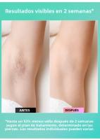 Epilador Láser 4-en-1 IPL Photoepilador Painless Máquina De Eliminación De Vello Permanente Para Cuerpo Y Rostro Epilador Eléctrico Para Mujeres - details 4