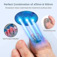 Dispositivo de tratamiento láser de los colores en las uñas para múltiples uñas, use en el hogar 910nm Luz infrarroja + 470Nm Luz Azul uñas - details 3