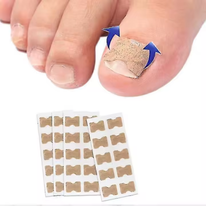 100 parches correctores para uñas de los pies, sin pegamento, para pedicura, corrector para uñas encarnadas. - 1