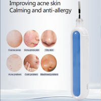 Limpieza Profunda De Pores Portátil Espátula Exfoliante Facial Ultrasonido Espátula De Piel Ultra Espátula De Cuidado De Piel - details 2