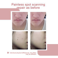 Plasma Pen Herramienta De Belleza Para Eliminar Vainillas Manchas De Piel Nevo Y Tatuajes Con LCD 9 Niveles USB Cable - details 9