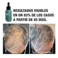 Tahe Pack Concentrado 200 ml + Champú 300 ml Peptide T98 | Pack que incluye los productos Concentrate Peptide T98, un tratamiento anticaída densificante, y Shampoo Peptide T98, champú anticaída densificante. - details 7