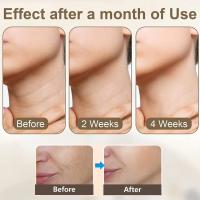 Instrumento de belleza para el cuello para eliminar las líneas del cuello y los pliegues nasolabiales, instrumento de belleza, instrumento de introducción reafirmante y lifting de luz facial, microcorriente EMS blanca - details 6