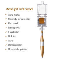 ZGTS Derma Roller De 540 Agujas Para El Rostro Y El Cuerpo Cuidado De La Piel Y Crecimiento Del Vello Profesional Herramienta De Belleza Microneedle Roller - details 0
