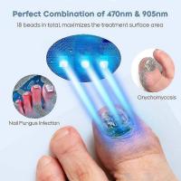 Polytoenail Hongo Dispositivo de Tratamiento Láser Hogar 905nm Luz Infrarroja + 470Nm Luz Azul Uñas Fungu ZHX - details 0