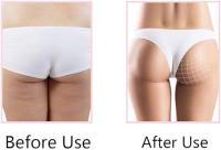 Ejercitador de Piernas y Músculo Kmt Style | Equipo de Ejercicio para Muslos y Piernas - details 4