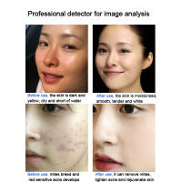Nueva Máquina De Burbujas De Oxígeno Mágica Limpieza Profunda Piel Suave Y Blanca Eliminación De Piojos Belleza Rejuvenecimiento Facial Japón Dispositivo De Gestión - details 6