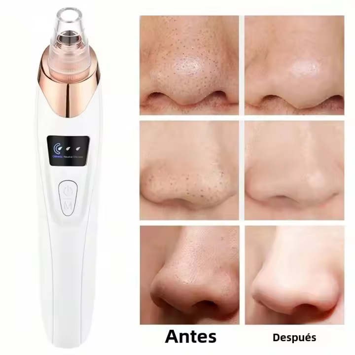 Máquina eléctrica de exterminio de insectos y puntos negros, limpieza profunda de la piel, limpieza de poros, adecuada para herramientas de cuidado facial de todas las edades - 1