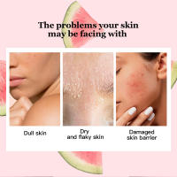 Suero, Suero de niacinamida de sandía, Gotas hidratantes e iluminadoras de niacinamida de sandía, Suero facial con ácido hialurónico, glicerina y vitamina E, Abrillantador líquido - details 3
