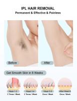 Dispositivo De Eliminación De Vello IPL 990000 Pestañas Láser Para Mujeres Eliminador De Vello Permanente Para Cuerpo Bikini Y Facial - details 21