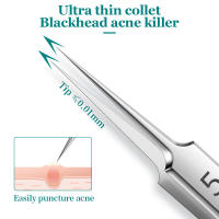 Herramienta De Limpieza De Pores Y Remoción De Acné Con Agujas Para Eliminar Quistes Y Manchas En La Piel Set De 5/8 Piezas - details 4
