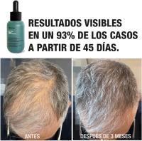 Tahe Concentrado anticaída densificante con multipéptidos Peptide T98 50 Ml. / Frena la caída y activa el crecimiento desde la raíz. - details 6