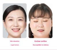 Eléctrico de papada y Máquina V-face dispositivo con 4 Modos Y 3 engranes de intensidad ajustable - Máquina intelente de papada para V-face/Gift de Navidad - details 12
