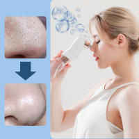 BIT Limpiador eléctrico de poros faciales, Extractor de succión al vacío de puntos negros, microburbujas pequeñas, espinillas y acné, limpieza profunda - details 7