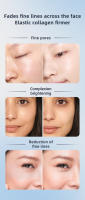 Masajeador Facial De 3 En 1 RF Calefacción EMS Con Rodillo De 360° Para Lifting De Piel Rejuvenecimiento Y Eliminación De Líneas Finas Máquina De Belleza Microcorriente - details 5