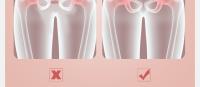Entrenador de Piernas - Ejercitador de Pelvis, Aductor y Muslos Internos con Hebilla Cuadrada GD para el Suelo Pélvico - details 4