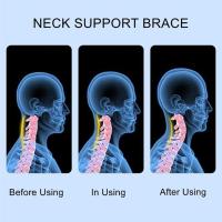 Soporte Ajustable Para El Cuello Alivio Del Dolor De Cuello Esponja Colar Cervical Para Hombres Y Mujeres Para Dormir Alivio De La Presión Cuidado De La Salud - details 6