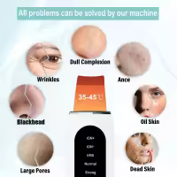 Limpieza Facial Profunda Con Scrubber Ultrasonido Eliminador De Quistes Faciales Ionizador De Poros Acné Limpieza De Piel Rechargeable Battery - details 1