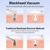 Limpiador De Puntos Negros USB Recargable Suction Vacío Facial Extractor De Comedones Quimono Negro Para Limpieza De Rostro - details 3