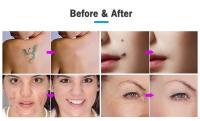 Plasma Pen De Ozono Profesional 2 En 1 Para Eliminar Manchas Y Lifting Facial Steriliza Y Remove Acné Skin Remover De Ojos Elevador - details 11
